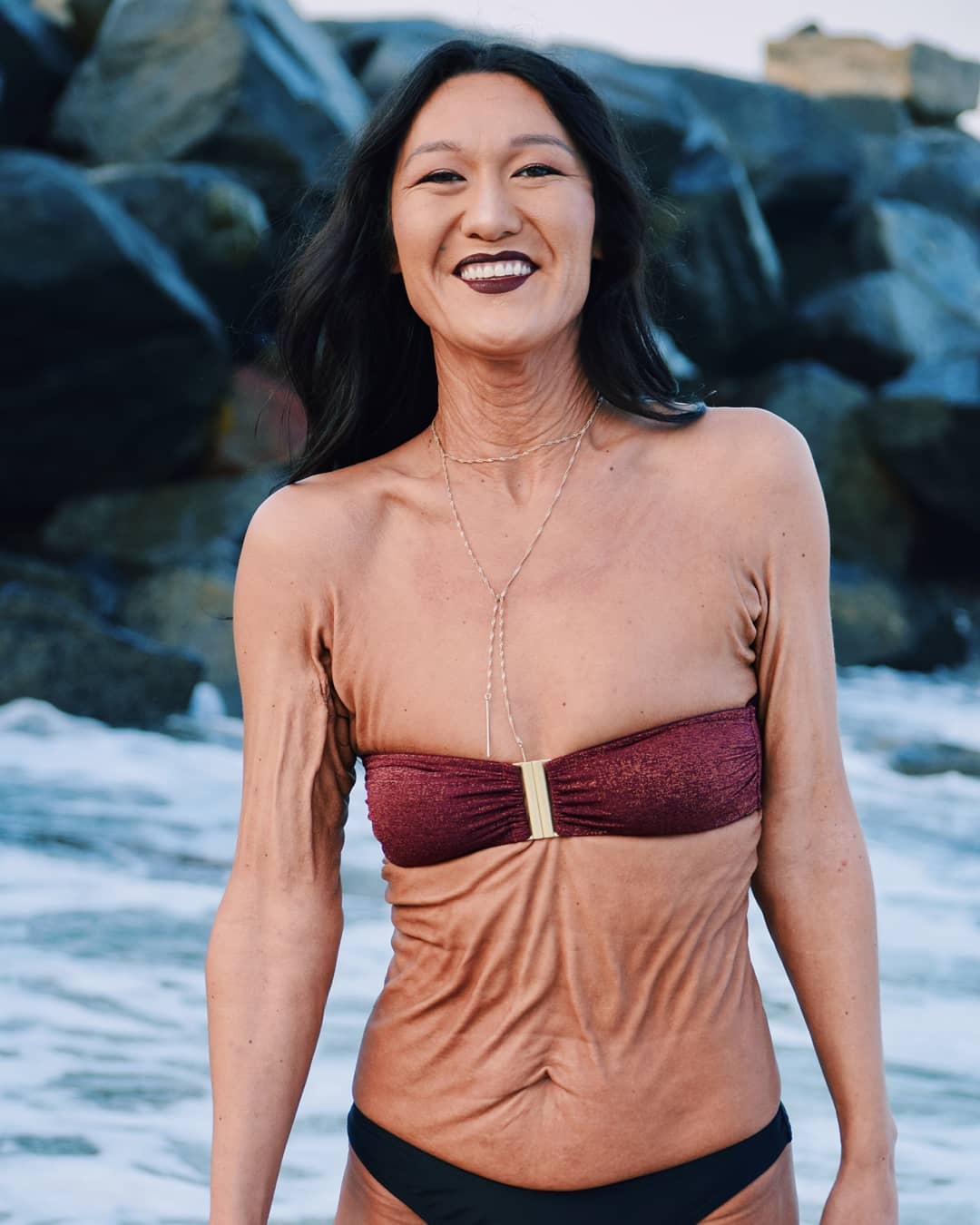 co gai 26 tuoi da nhan nheo nhu ba lao anh 5