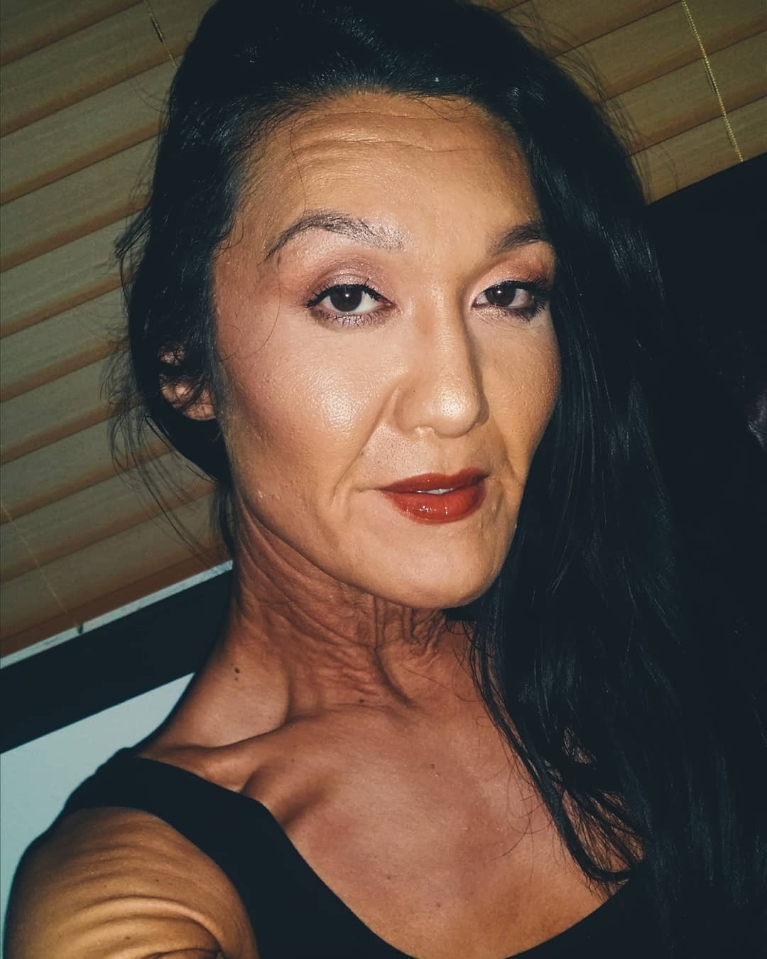 co gai 26 tuoi da nhan nheo nhu ba lao anh 1