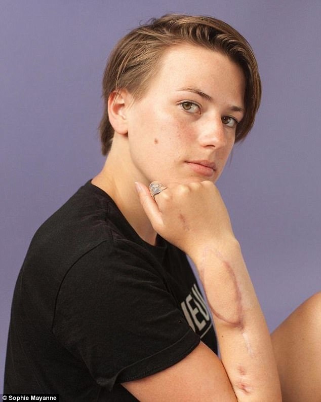 nhung co gai chia se cau chuyen sau vet seo anh 6