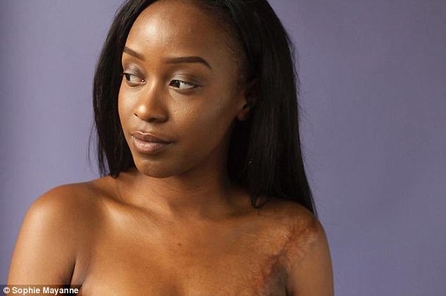 nhung co gai chia se cau chuyen sau vet seo anh 7