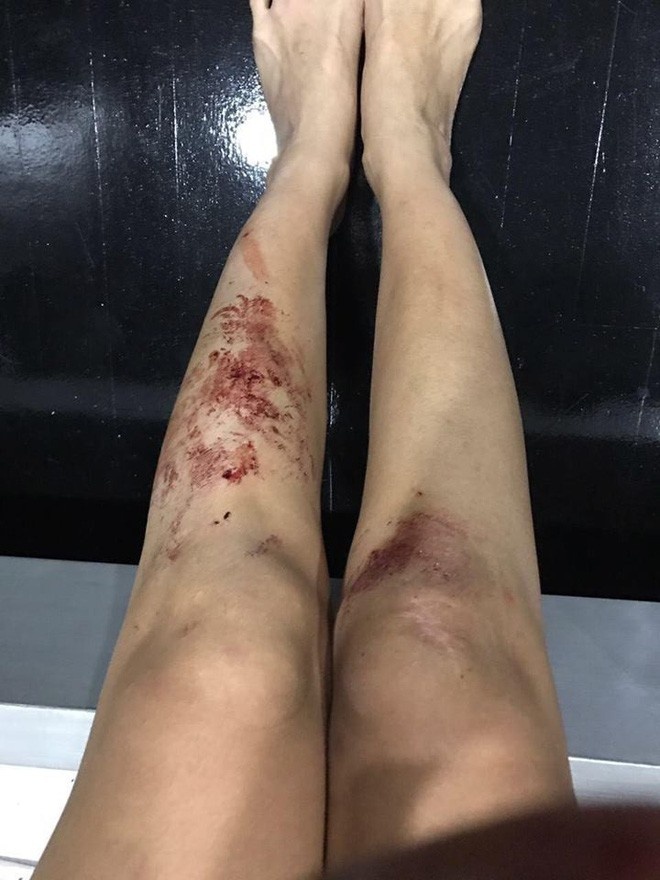 nữ DJ xinh đẹp bị bạo hành ảnh 2 nu DJ xinh dep bi bao hanh anh 2