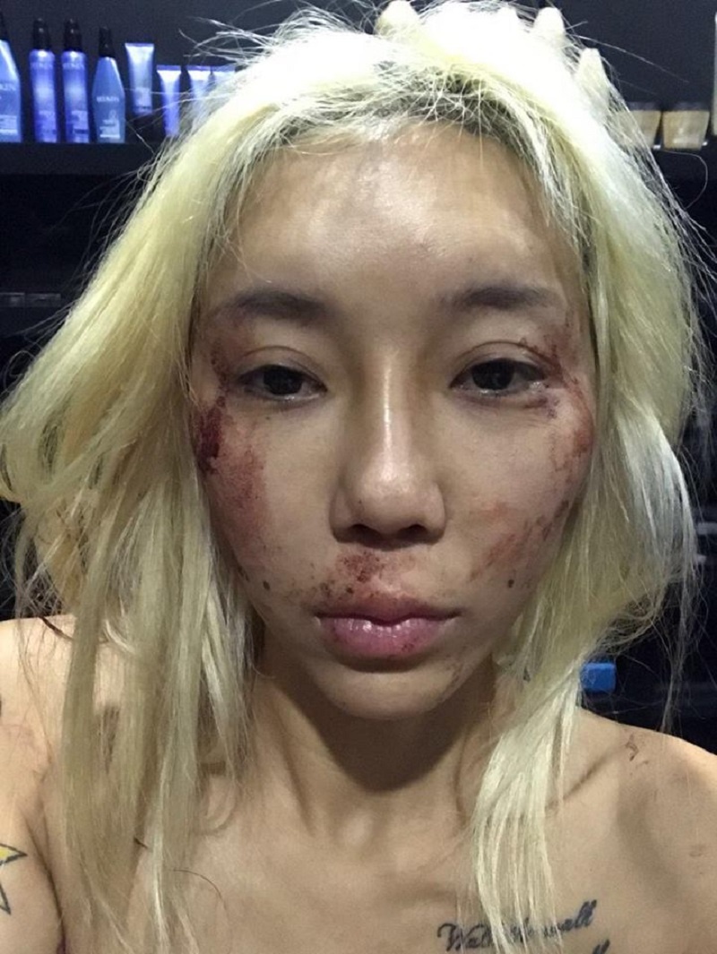 nữ DJ xinh đẹp bị bạo hành ảnh 5 nu DJ xinh dep bi bao hanh anh 5