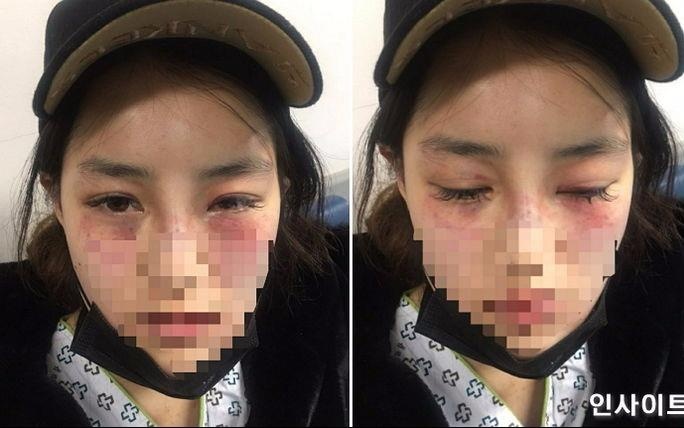 Nam sinh hanh hung ban gai da man trong thang may hinh anh