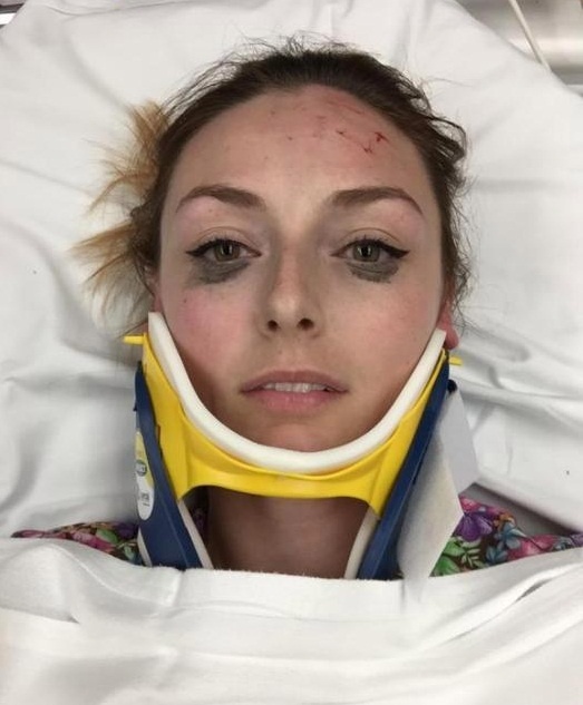 co gai bi tai nan van review but ke mat anh 2