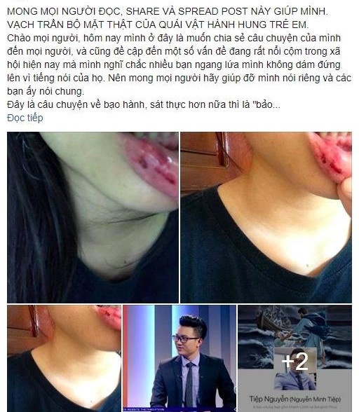 MC Minh Tiep bao hanh em vo anh 1