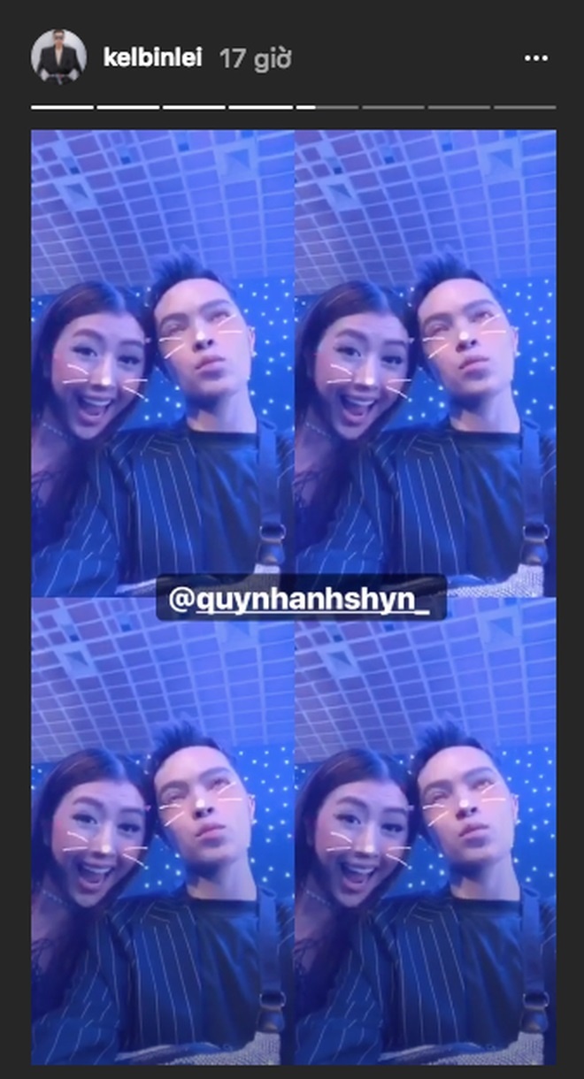 Quỳnh Anh Shyn lộ cằm nhọn ảnh 2 Quynh Anh Shyn lo cam nhon anh 2