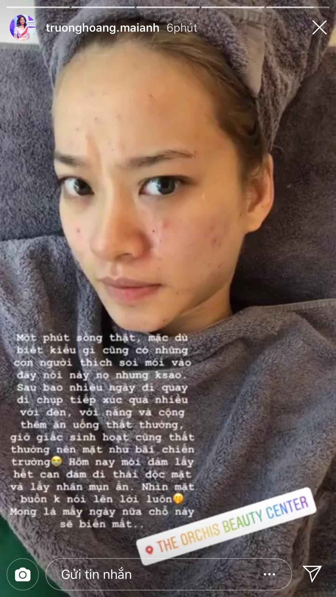 nhan sac hot girl de mat moc anh 11