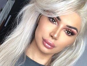 Chang trai phau thuat chuyen gioi de giong Kim 'sieu vong 3' hinh anh