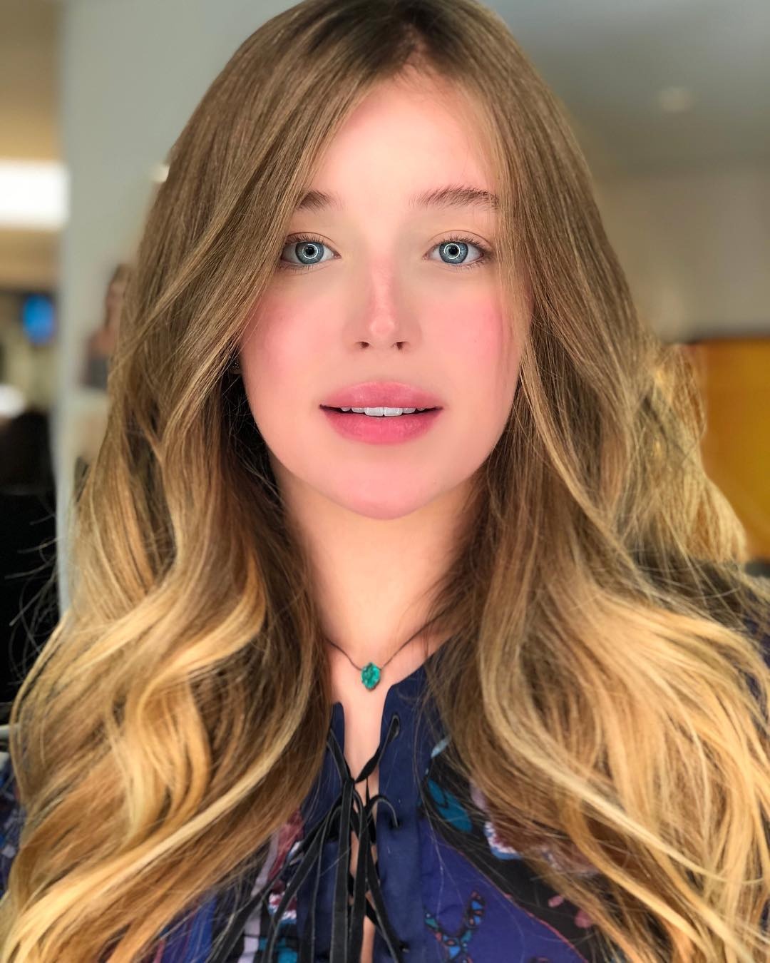 Nguoi mau co mau mat hiem nhat the gioi anh 1