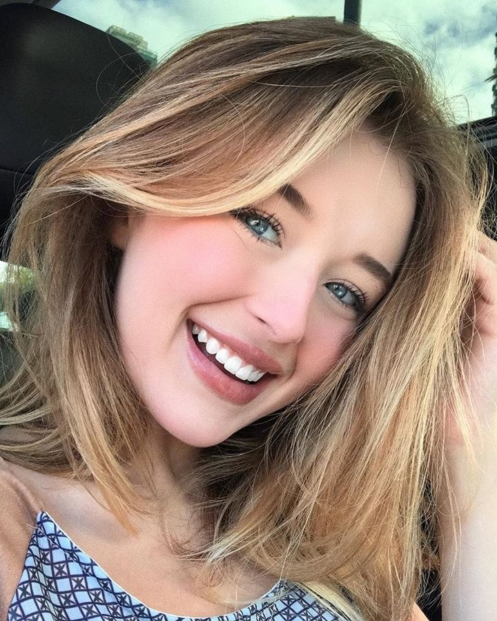 Nguoi mau co mau mat hiem nhat the gioi anh 16