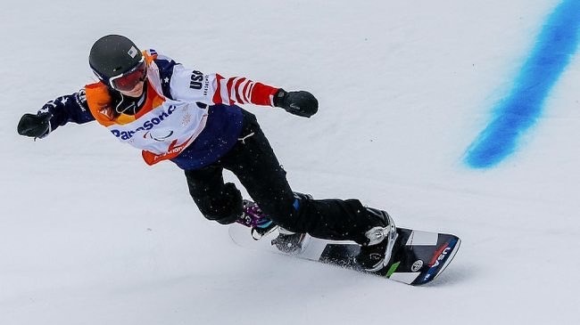 nguoi mau khuyet tat Brenna Huckaby anh 2