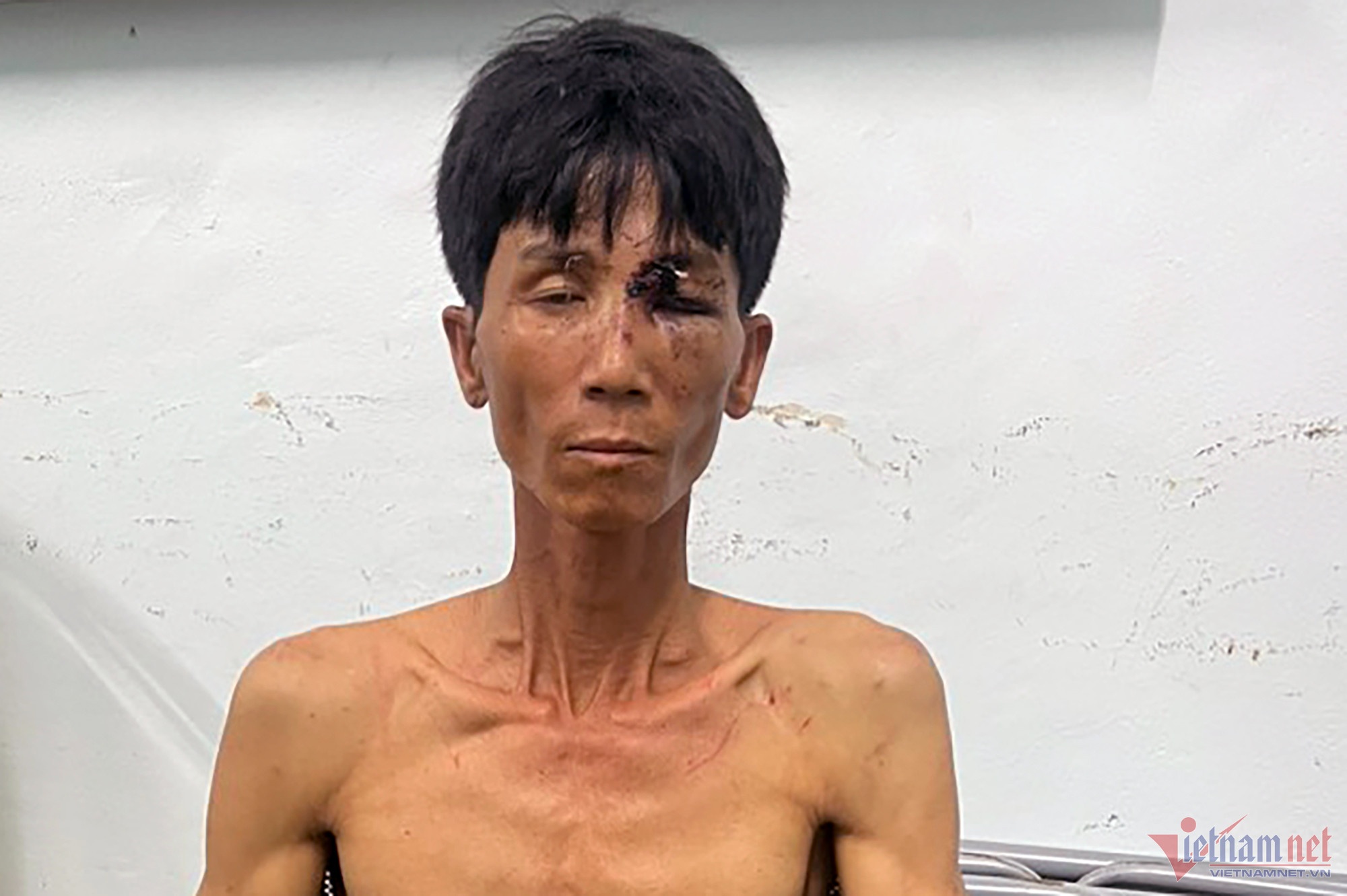 5 ngay tron chay cua nghi pham gay tham an o Khanh Hoa hinh anh