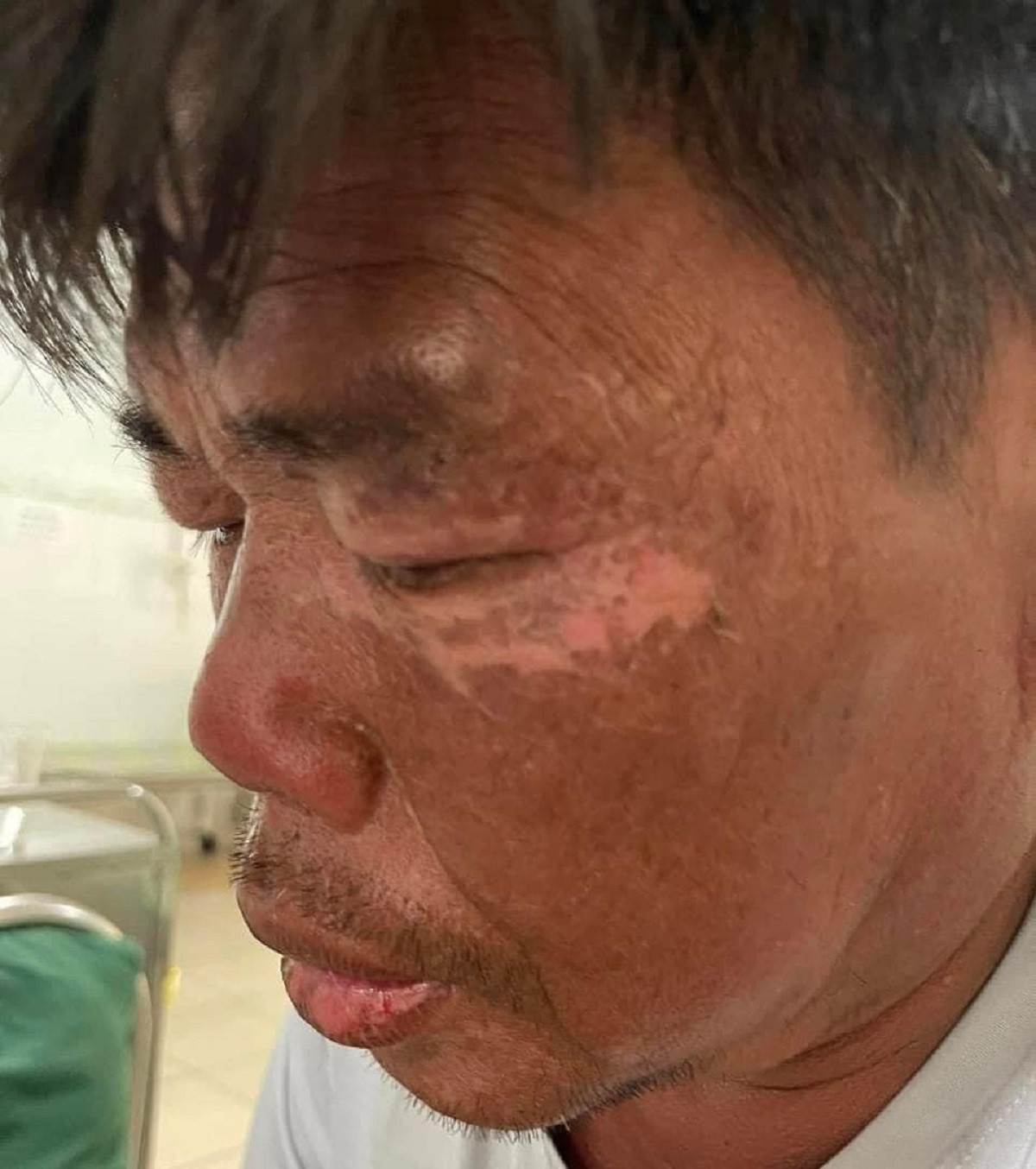 ngu dan nga xuong bien anh 2