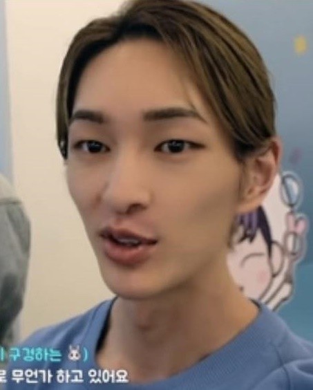 Onew gay go xuong sac anh 4