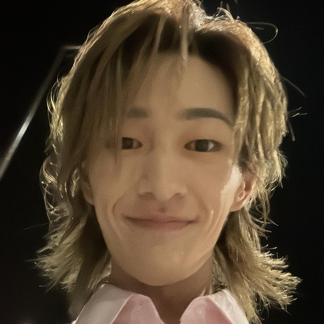 Onew gay go xuong sac anh 3