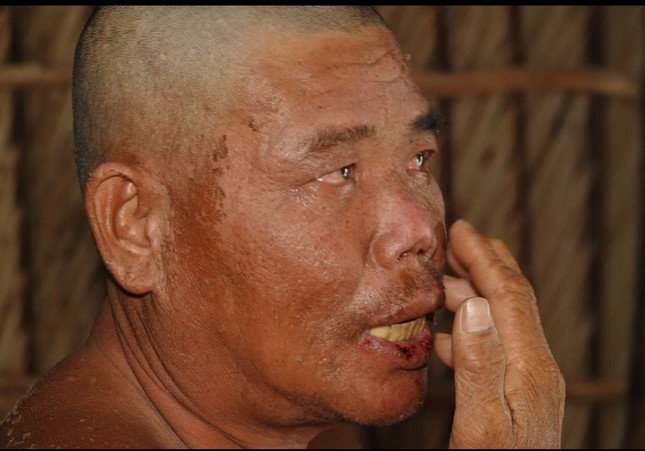 Gap ngu dan song sot than ky sau 4 ngay troi dat giua bien hinh anh