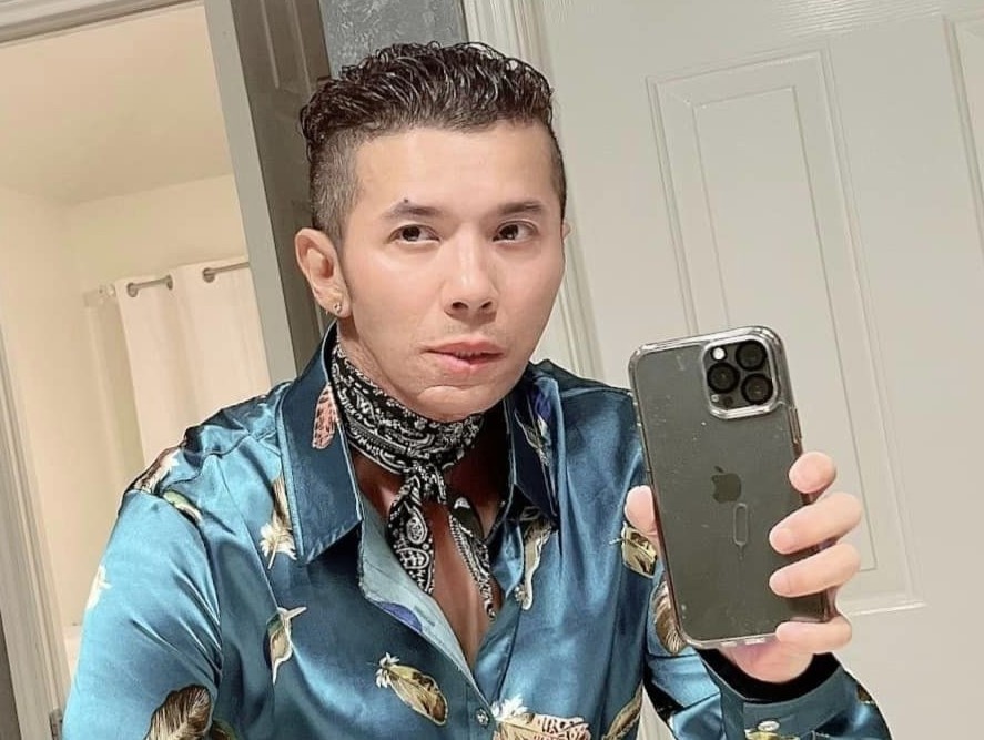 Ca si Kasim Hoang Vu xuat hien voi mat 'bien dang' hinh anh