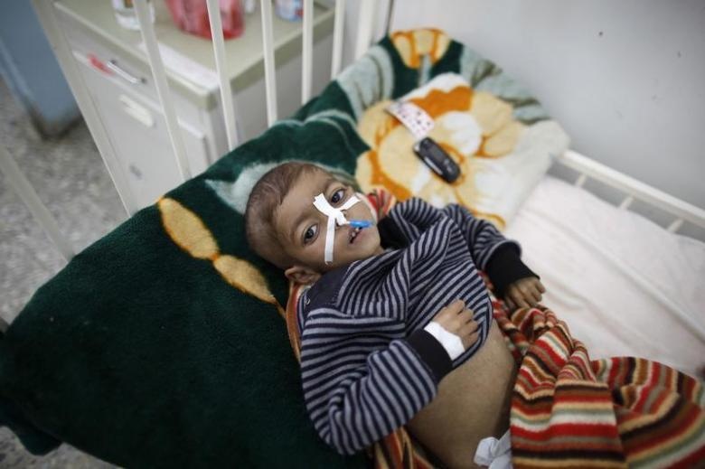 nan doi o Yemen anh 7