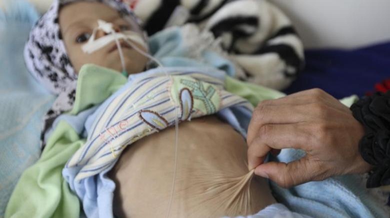 nan doi o Yemen anh 5