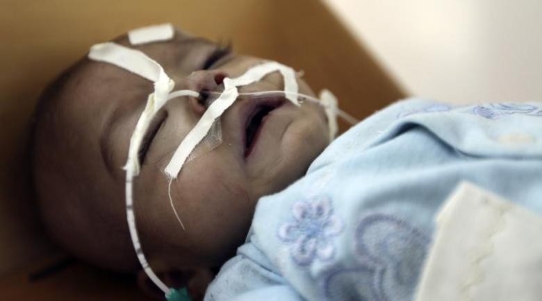 nan doi o Yemen anh 4