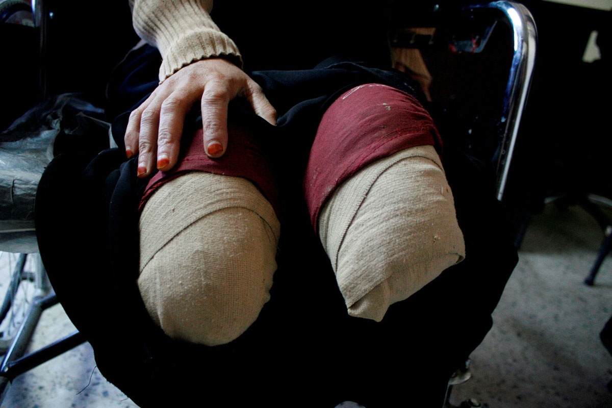 Noi chien o Yemen anh 5