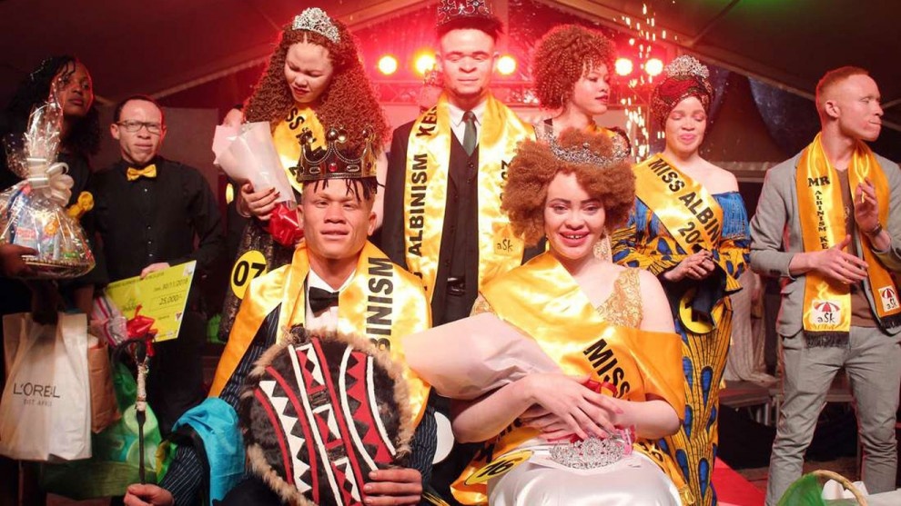 cuoc thi danh cho nguoi bach tang anh 4