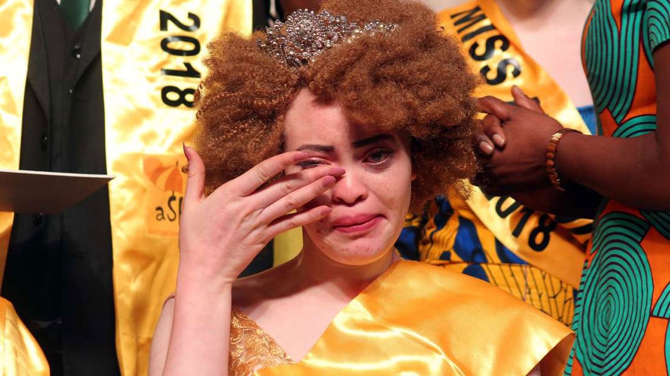 cuoc thi danh cho nguoi bach tang anh 5