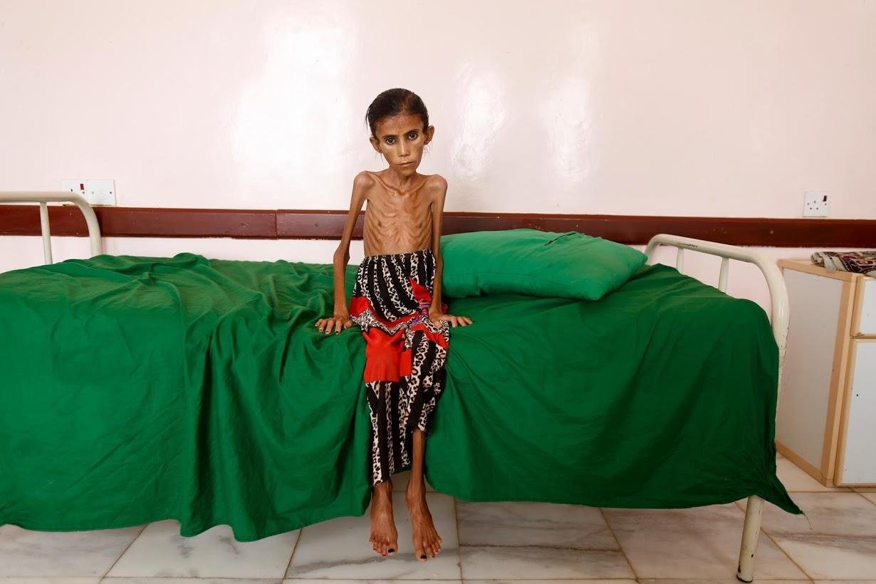 nan doi o nhung ngoi lang Yemen anh 8