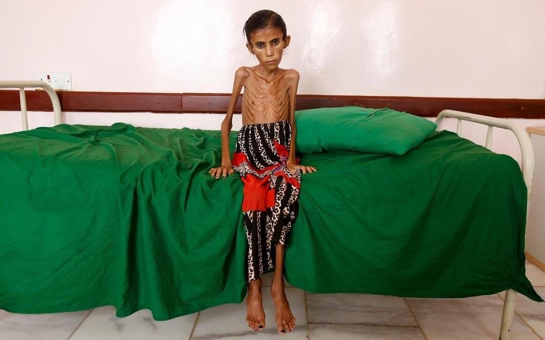 Nan doi de doa su song tai Yemen sau 4 nam noi chien hinh anh