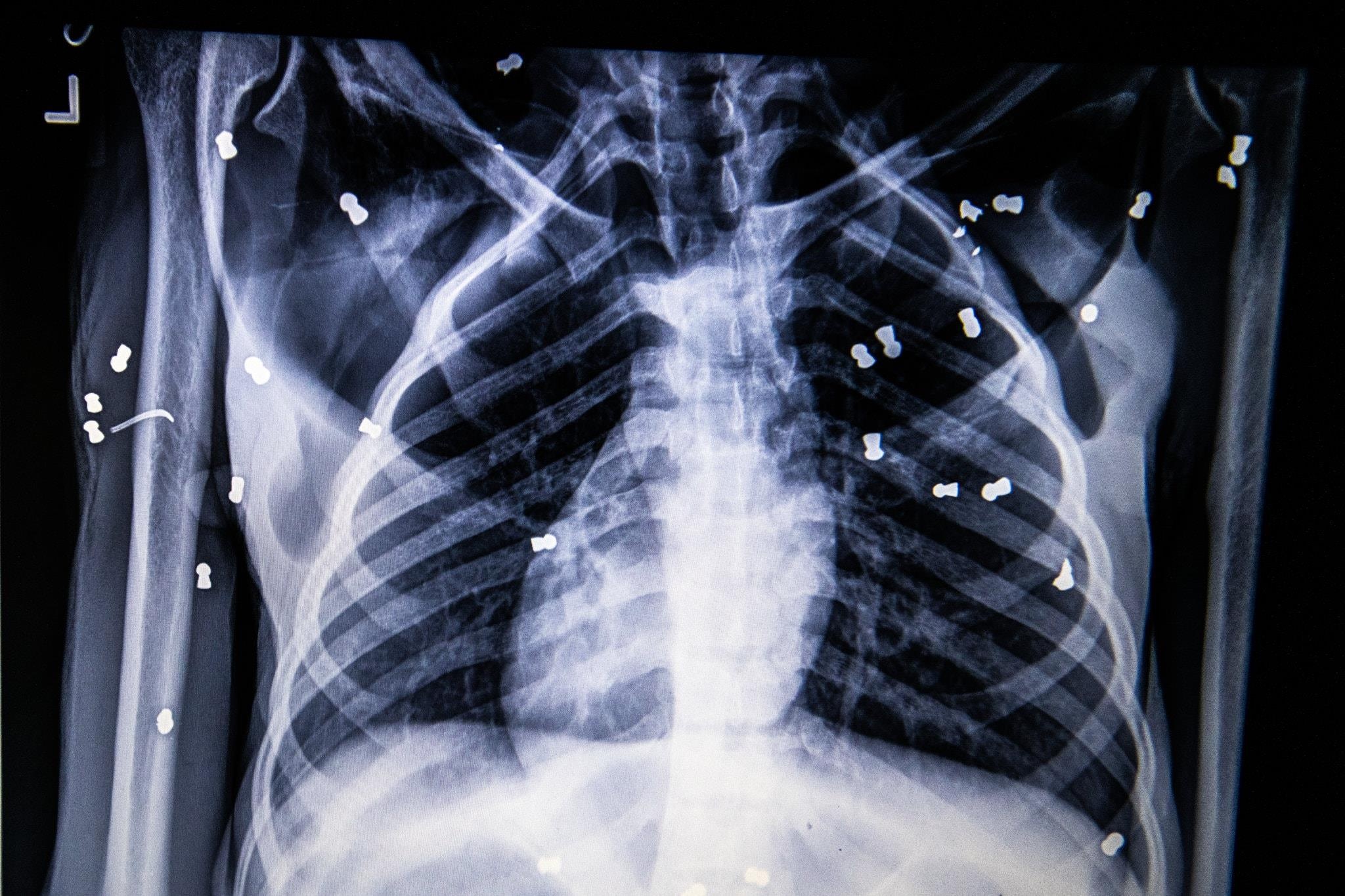 duoi uoi quy hiem anh 5