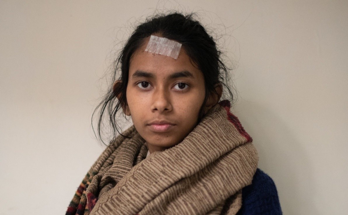 Co gai An Do thanh anh hung sau khi bi danh vao dau bang gay sat hinh anh