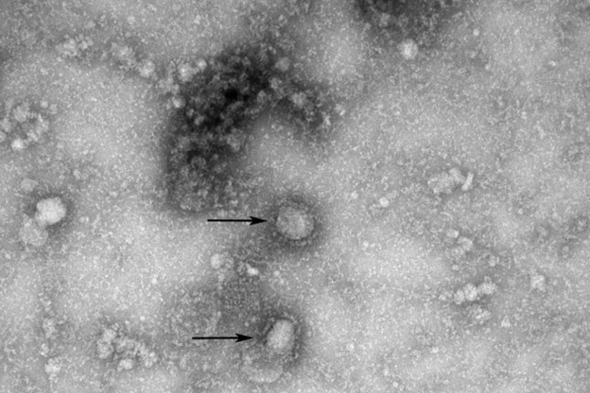 Phong thi nghiem cong bo trinh tu bo gen virus corona bi dong cua hinh anh