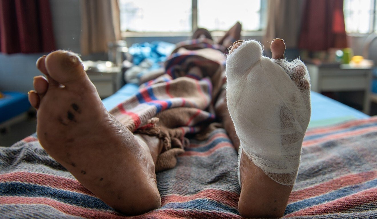 nguoi mac benh phong anh 4