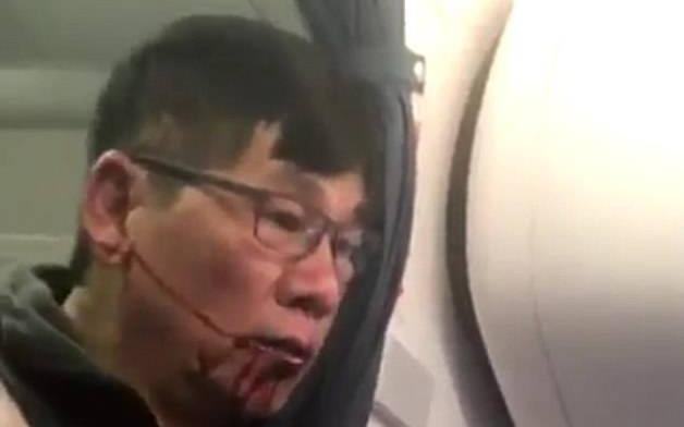 Dan mang phan no doi tay chay hang United Airlines hinh anh