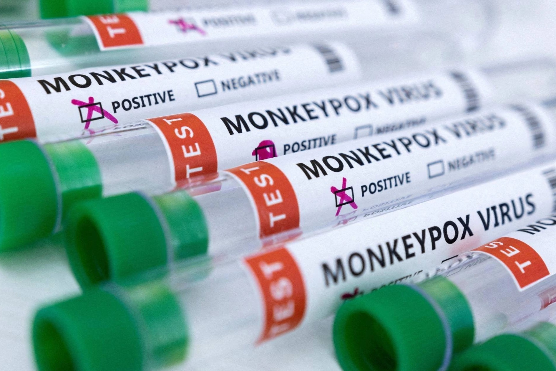 Benh dau mua khi co the gay cac van de than kinh hinh anh