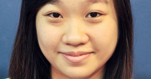 vi sao mui nguoi nuoc ngoai cao anh 1