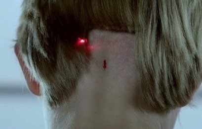 Con chip dau tien duoc cay vao nao nguoi hinh anh