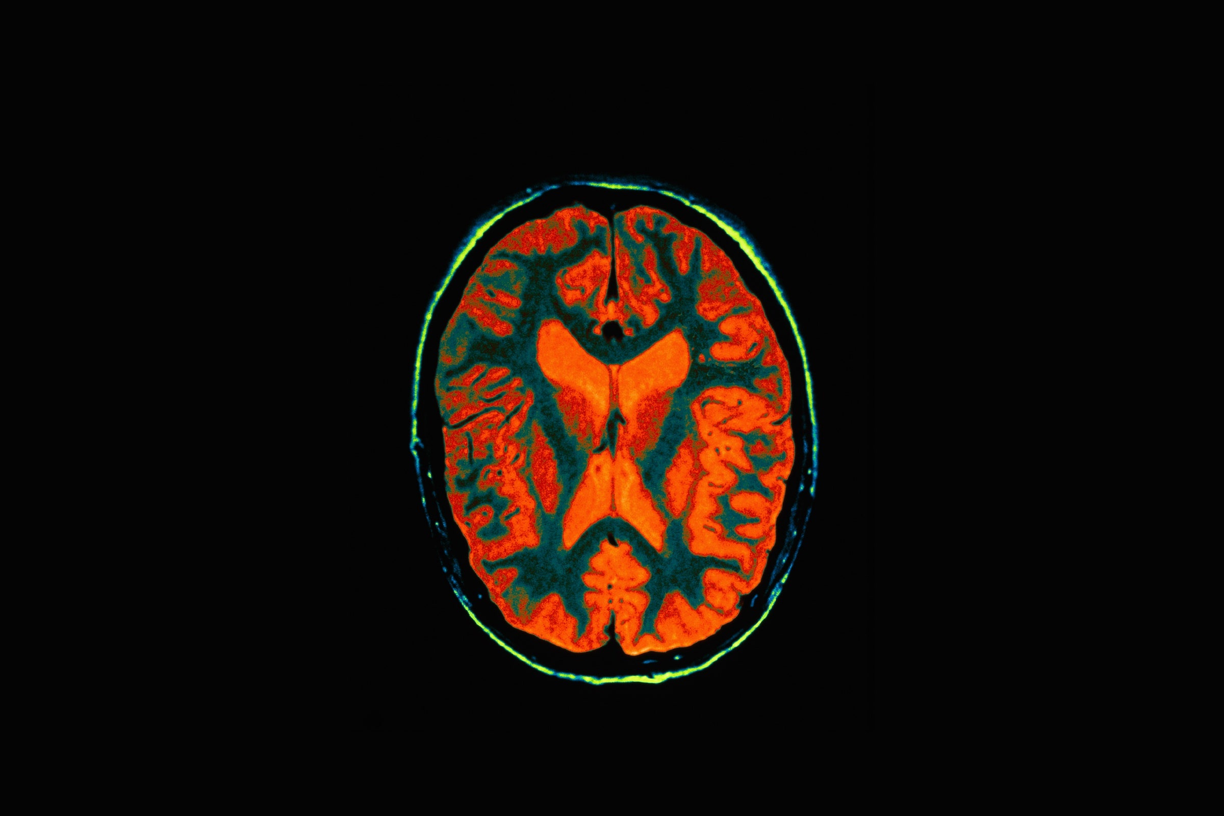 Cach giup ban ghi nho moi thu anh 1