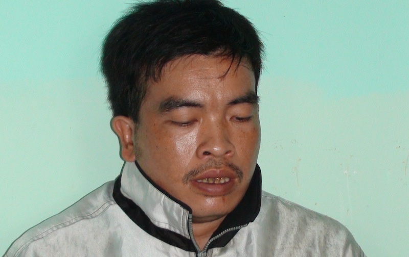 Dang ngu trua bi dong nghiep danh chan thuong so nao hinh anh