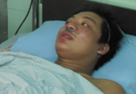 Suc khoe cong nhan song sot 'than ky' dang xau di hinh anh