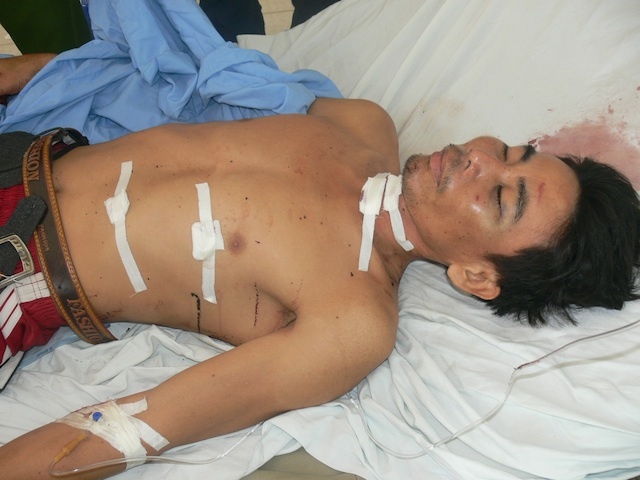 Hung thủ may mắn sống sót, điều trị tại bệnh viện