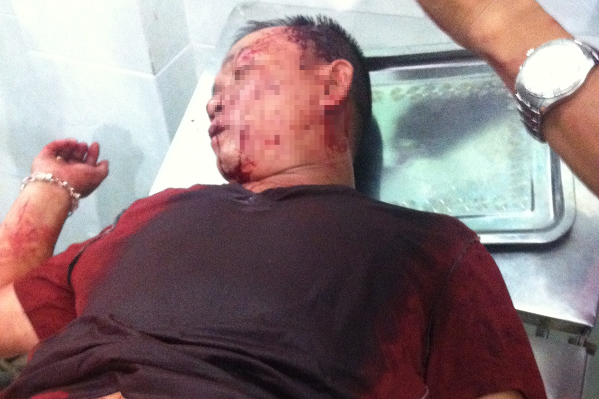 Dan quan bi to danh toac dau nguoi dan o Binh Duong hinh anh