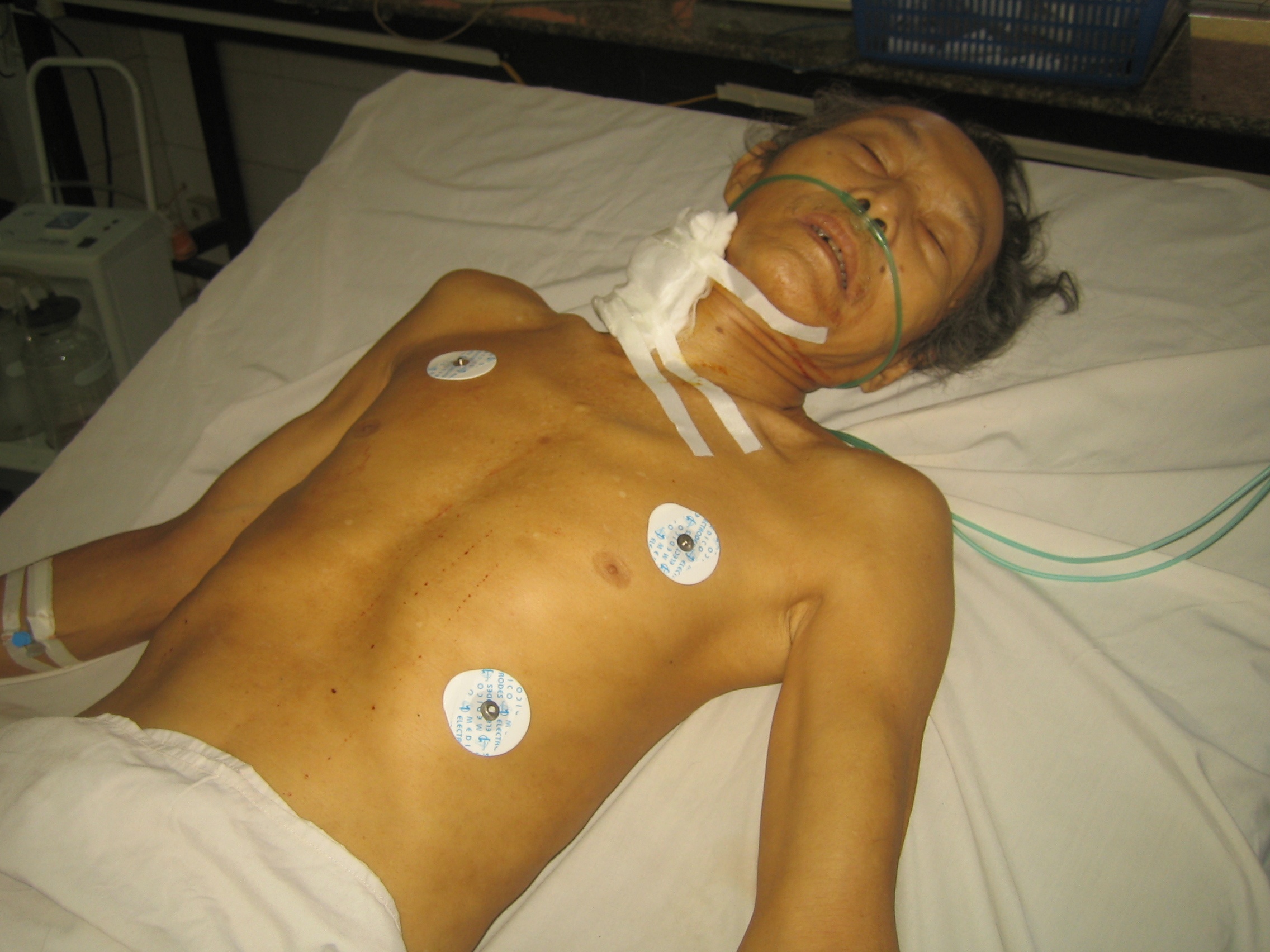 Cha dang ngu say thi bi con trai ke dao cua co hinh anh