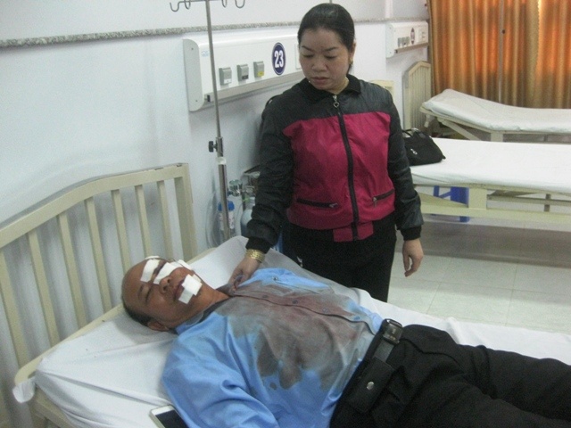 Hat truong duong bo bi giam doc cong ty danh rach mat hinh anh