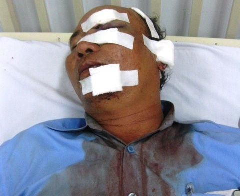 Giam doc lam rach mat hat truong muon cho nan nhan danh lai? hinh anh