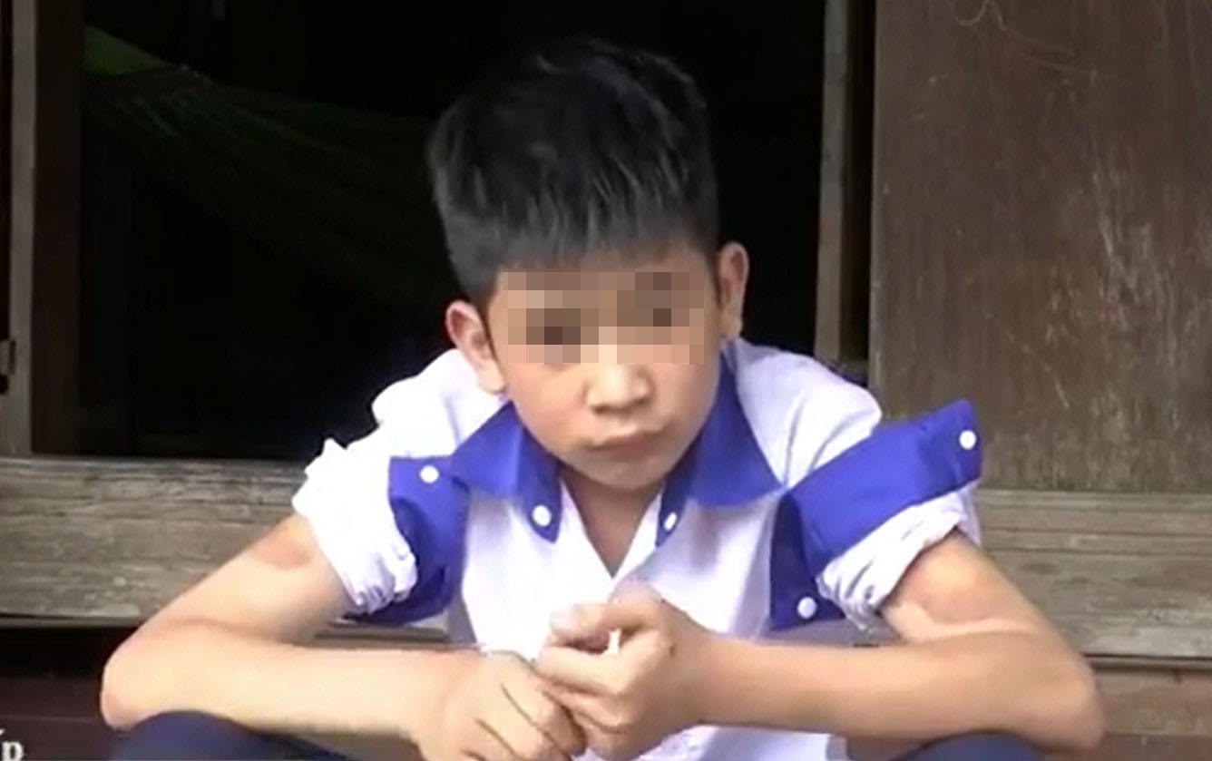 Nam sinh to me ke danh bam tim chan tay bang day dien, xich sat hinh anh