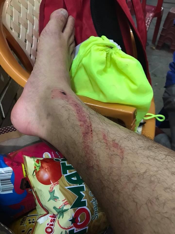 Van Hao chan thuong,  Duong Van Hao,  CLB Long An,  trong tai V.League, anh 4