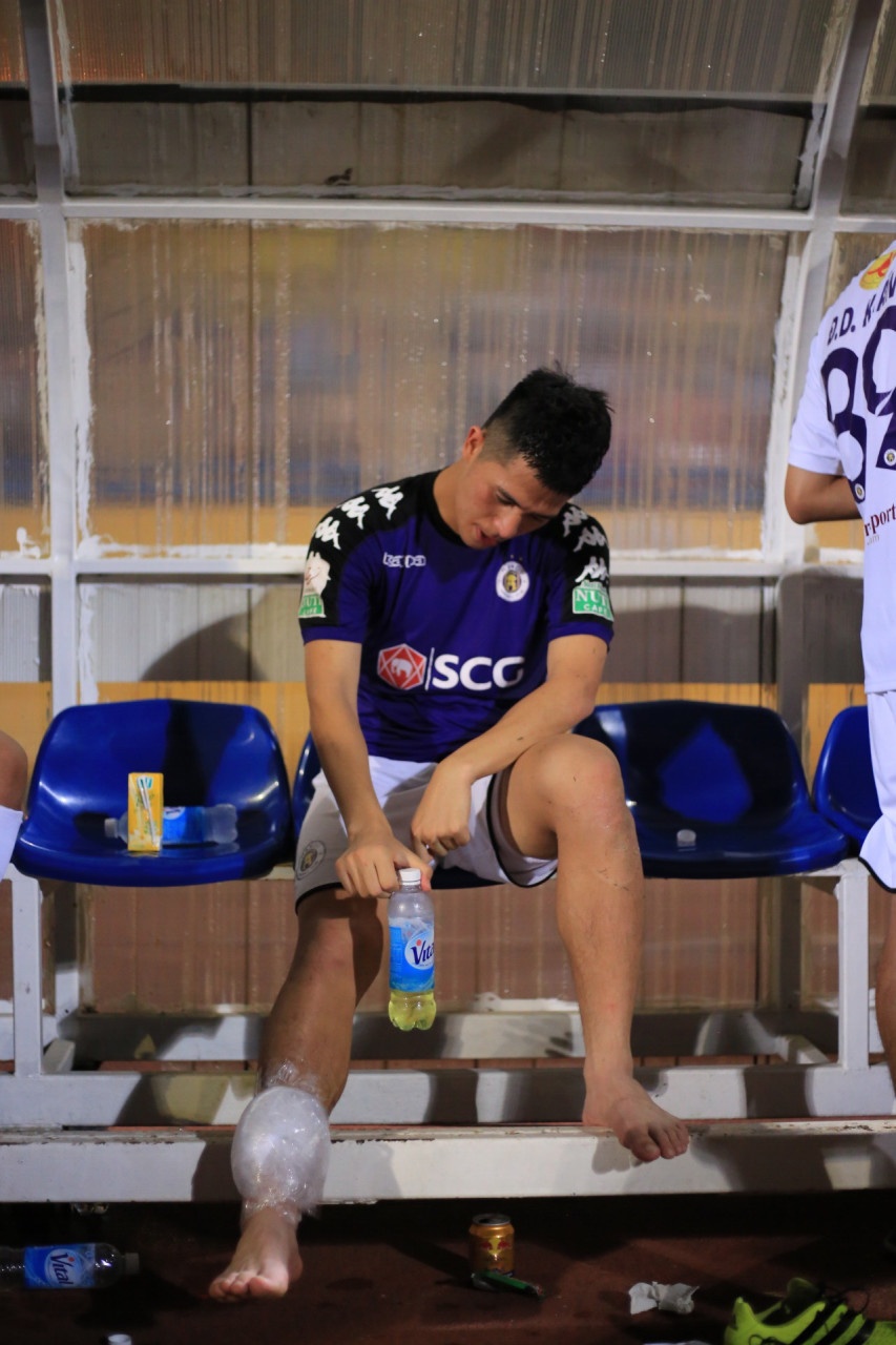 Dinh Trong,  CLB Ha Noi,  chan thuong,  V.League 2018 anh 1