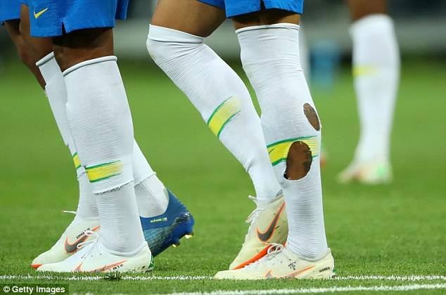 Neymar, tất rách, World Cup 2018 ảnh 1 Neymar, tat rach, World Cup 2018 anh 1
