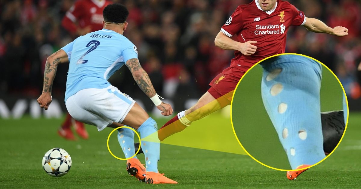 Neymar, tất rách, World Cup 2018 ảnh 2 Neymar, tat rach, World Cup 2018 anh 2